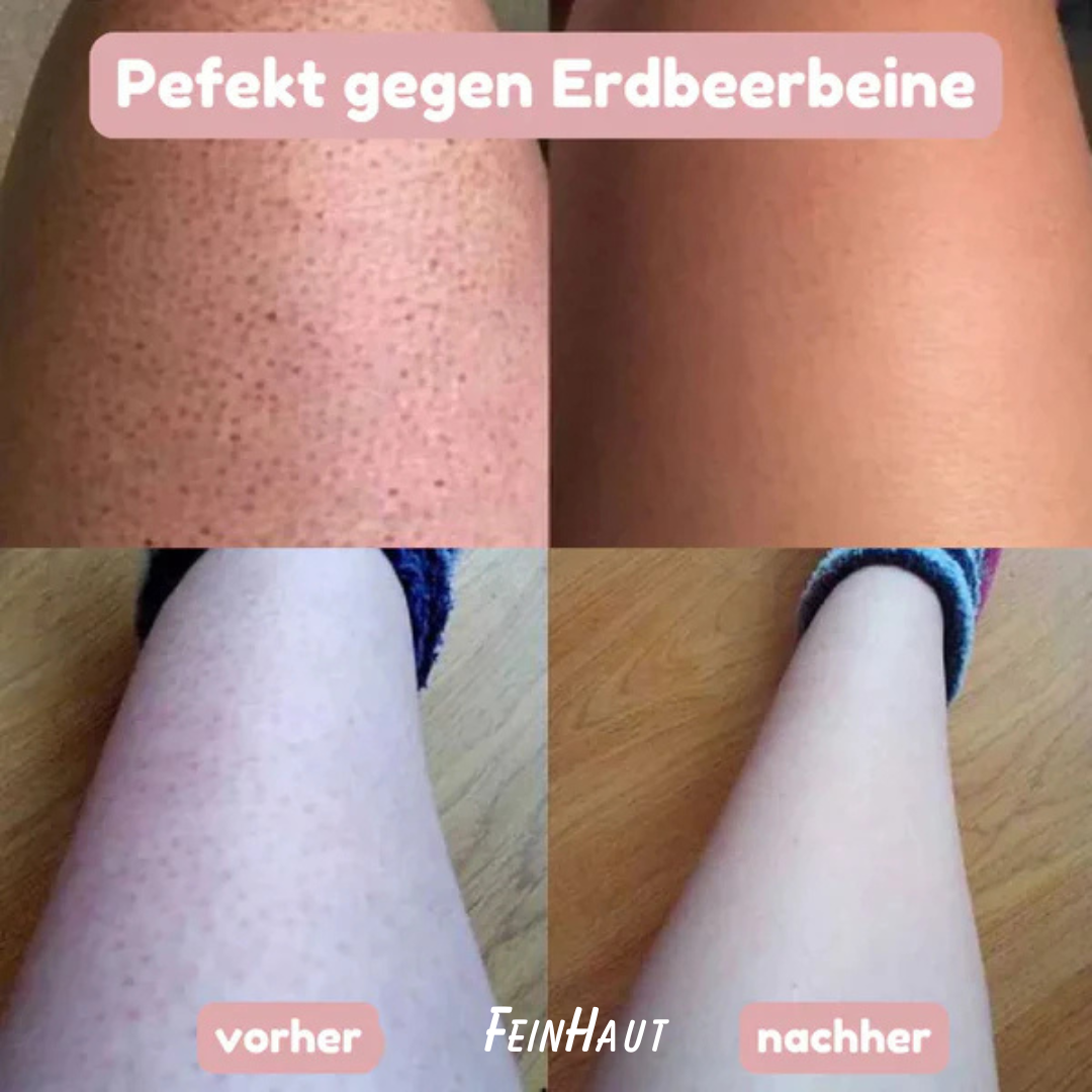 Feinhaut – SlikShave™