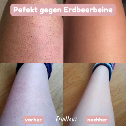 Feinhaut – SlikShave™