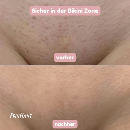 Feinhaut – SlikShave™